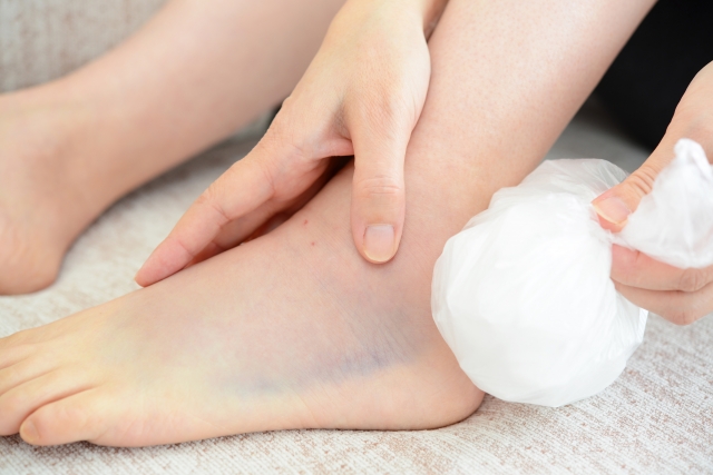 足の怪我の症状と見分け方！捻挫と骨折の違いと適切な対処法